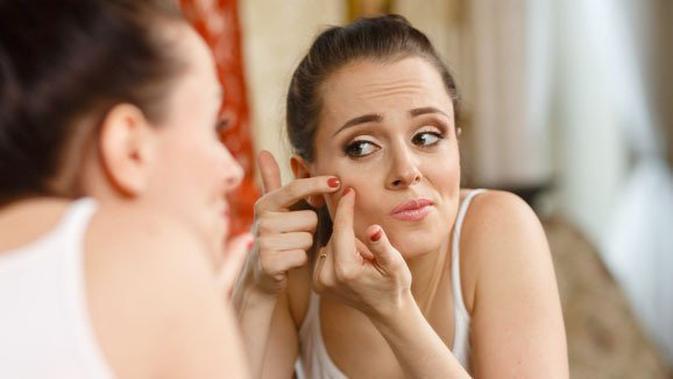 Tips Hilangkan Jerawat Menstruasi Hanya Dalam 1 Hari Saja Beauty