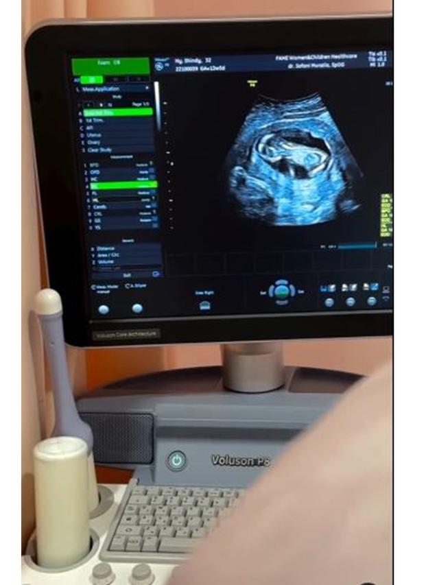 6 Potret Kakak Ria Ricis Umumkan Kehamilan Kedua, Baby Bump Mulai Terlihat