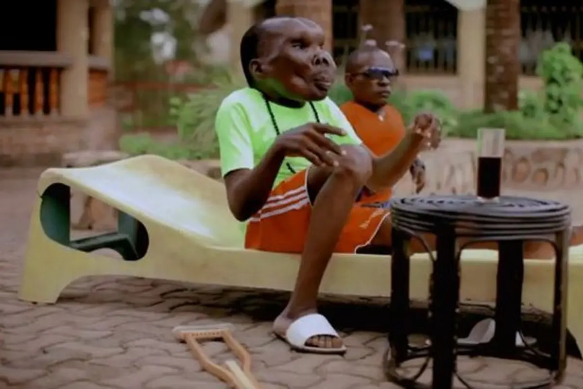 [Bintang] Cacat Wajah, Pria Uganda Ini Sukses Jadi Pop Star di Youtube!