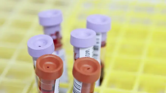 Ilustrasi gula darah