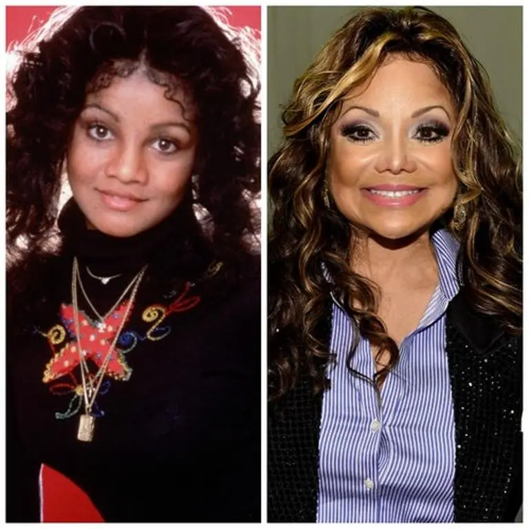 Bukannya tambah cantik, operasi yang gagal bikin wajah 5 selebriti ini terlihat aneh. (Sumber Foto: lifeandstylemag.com)