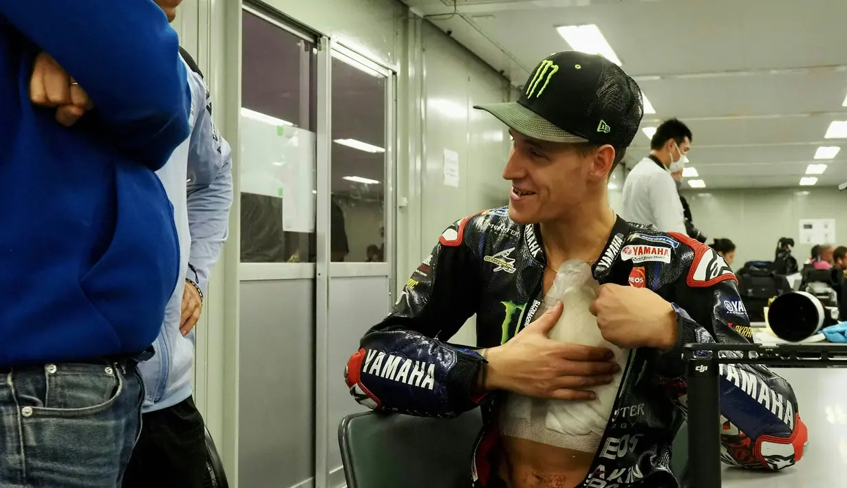 Luka yang didapatkan Quartararo usai resleting baju balapnya sempat terbuka saat terjatuh dari motor Yamaha M1 yang ditungganginya. (AFP/Toshifumi Kitamura)