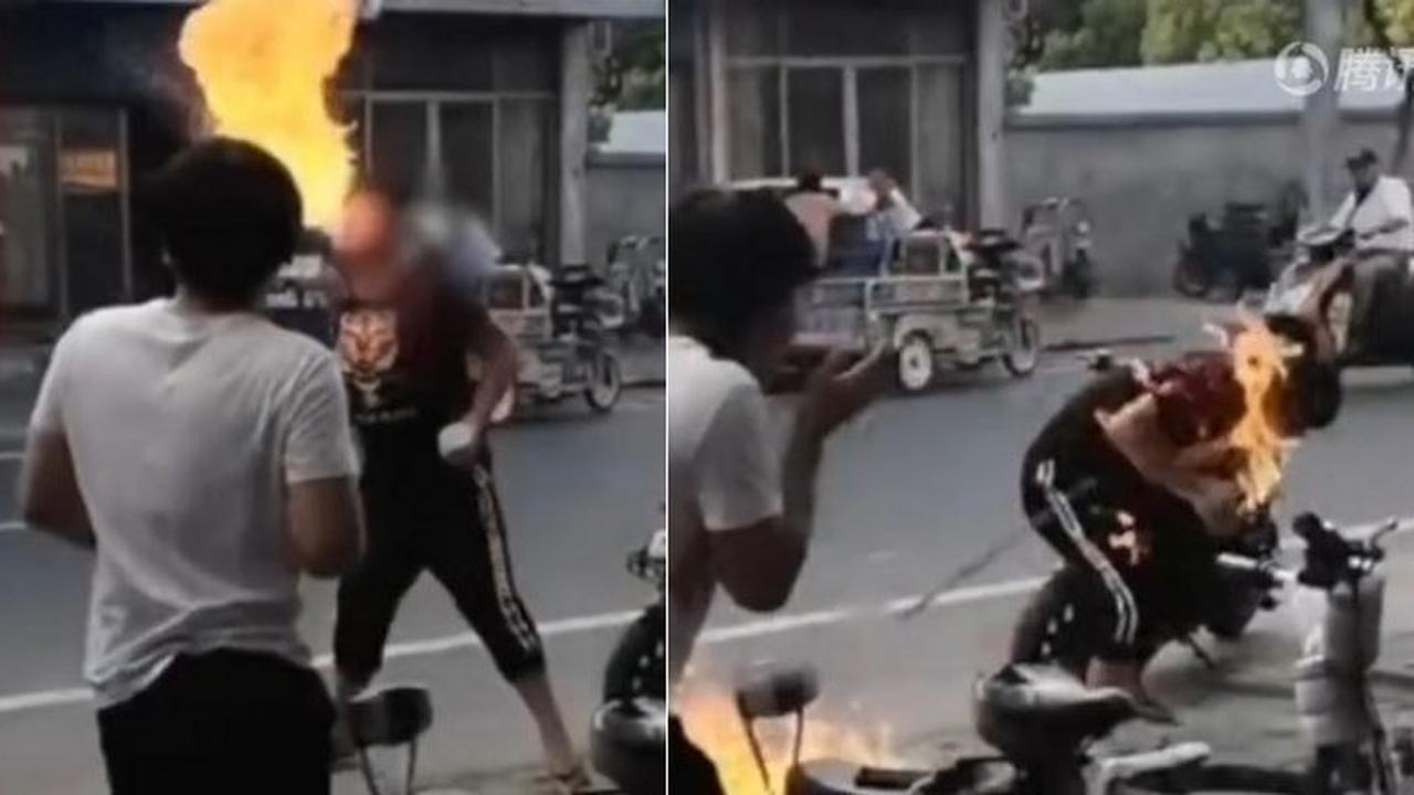 Tunjukan Kehebatan Bermain Api, Wajah Remaja ini Malah Terbakar