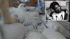 Timiyah Landers, seorang gadis yang memberanikan diri melakukan aksi ‘Fire Challenge’ bersama dua temannya yang akhirnya malah terbakar.