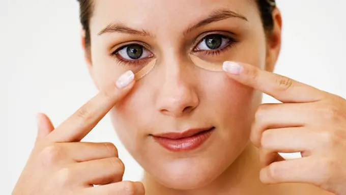 Kantung mata bikin penampilan jadi nggak maksimal/copyright: thinkstockphotos.com