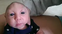 Lahir dengan Otak Setengah, Jaxon Rayakan Ultah Pertama