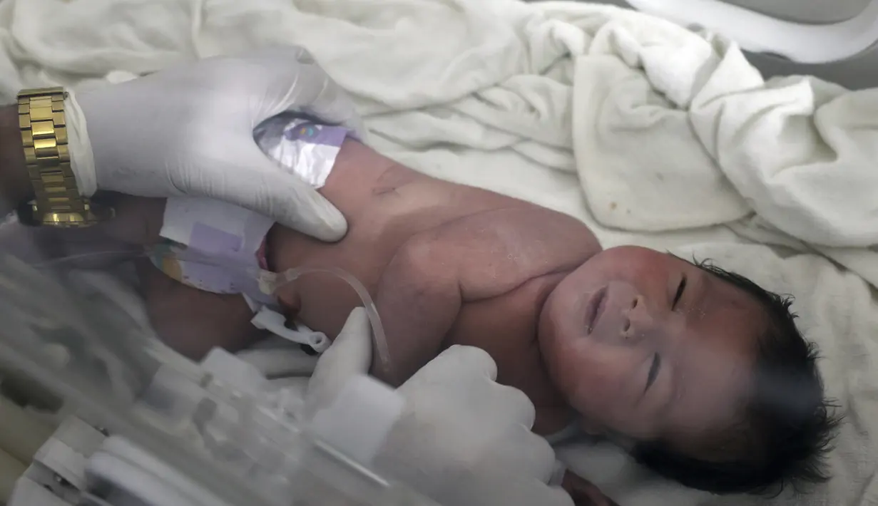 Seorang bayi perempuan yang lahir di bawah reruntuhan akibat gempa bumi yang melanda Suriah dan Turki menerima perawatan di dalam inkubator di rumah sakit anak di kota Afrin, provinsi Aleppo, Suriah, Selasa (7/2/2023). Dahi dan jari-jarinya masih membiru karena kedinginan saat dokter anak Hani Maarouf memantau bagian vitalnya. (AP Photo/Ghaith Alsayed)