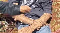 Pria di&nbsp;Kota Sukabumi, Jawa Barat (Jabar)&nbsp;tubuhnya dipenuhi kutil dan telah dibiarkan tanpa pengobatan selama puluhan tahun. (Liputan6.com/Fira Syahrin)