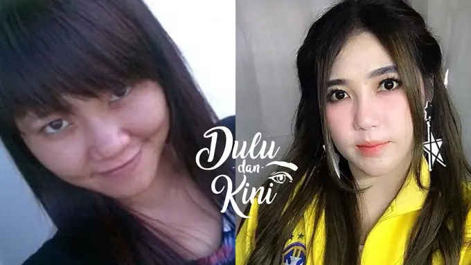 Dulu dan Kini: Transformasi Via Vallen, dari Ngga Banget Hingga Cantik Bukan Main