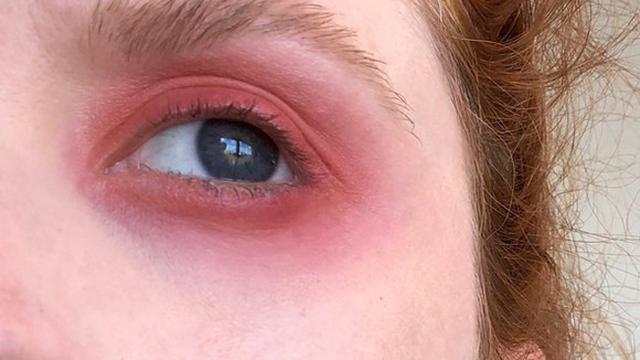 Sunburn Makeup, Tren Riasan Teranyar yang Wajib Dicoba