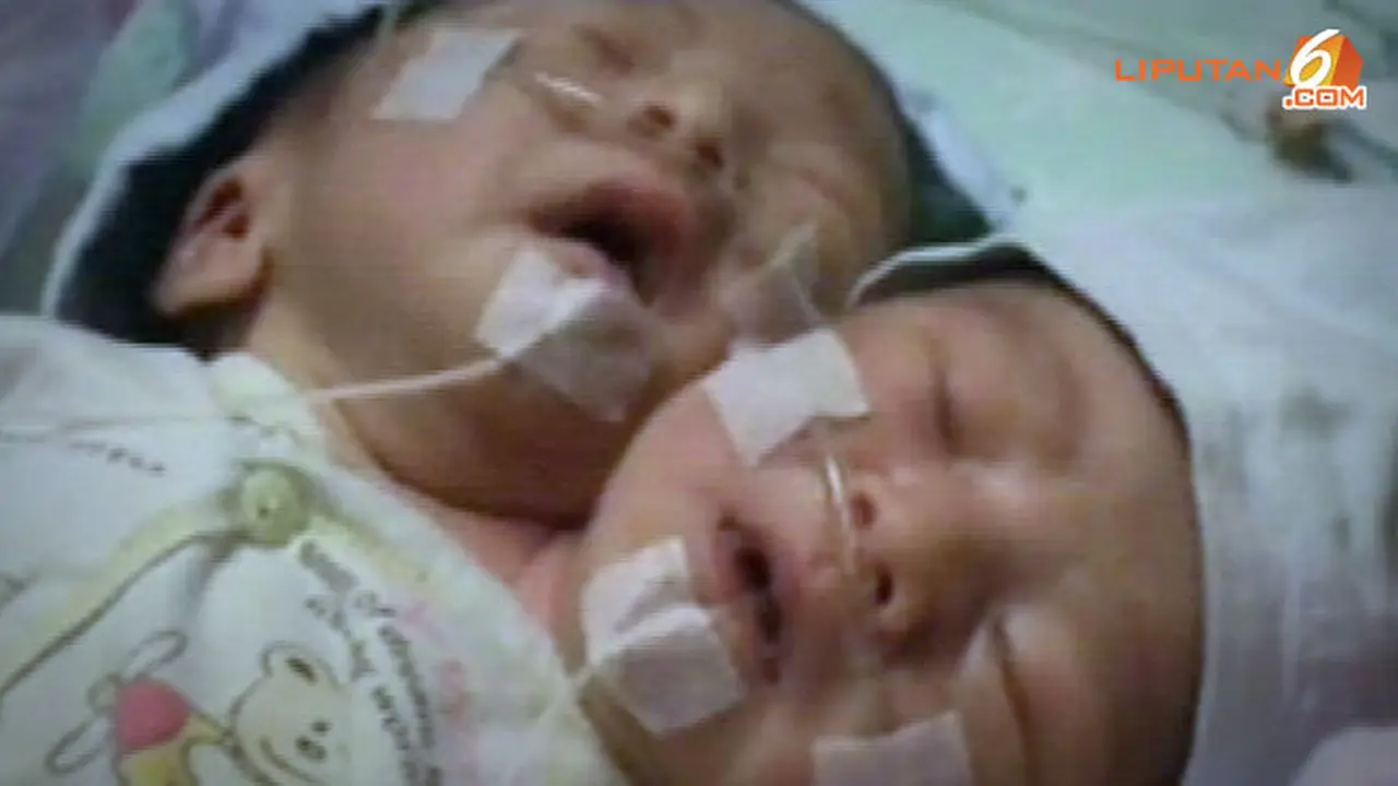 bayi-2-kepala130629c.jpg