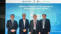 Kasus IBD Jadi Sorotan, Para Ahli Kesehatan Beberkan Sejumlah Fakta