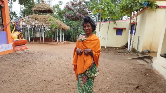 wanita miliki 31 jari
