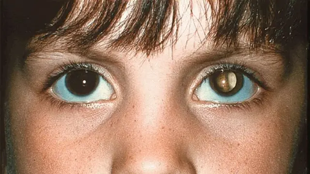 Ilustrasi. (foto: Pinterest).