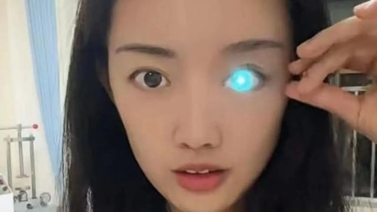 Buta Karena Kecelakaan, Mata Wanita Ini Bisa Berubah Warna Bak Robot