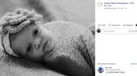 Kelainan di Lidah Bayi Bikin Lucy Tak Bisa Menyusu