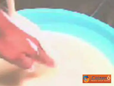 Obat Luka Bakar 