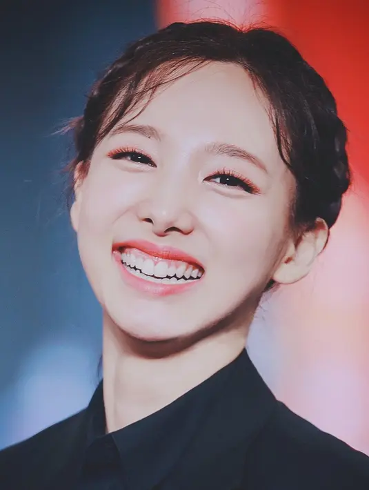 Bukan oplas wajah, Nayeon memutuskan untuk mengubah bentuk gigi kelincinya. [Pinterest]