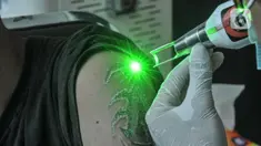 Peserta menjalani pengapusan tato dengan mesin laser di Masjid Baitul Muhyi, Jakarta Timur, Jakarta, Kamis (29/4/2021). Dalam rangka menyemarakkan bulan suci Ramadan, IMS bekerja sama dengan Baznas (Bazis) DKI Jakarta menggelar layanan hapus tato gratis. (merdeka.com/Iqbal S. Nugroho)