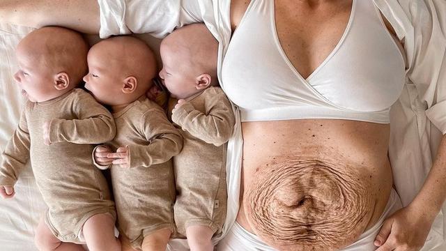 Wanita ini Bagikan Momen Kehamilannya dengan Bayi Kembar 3