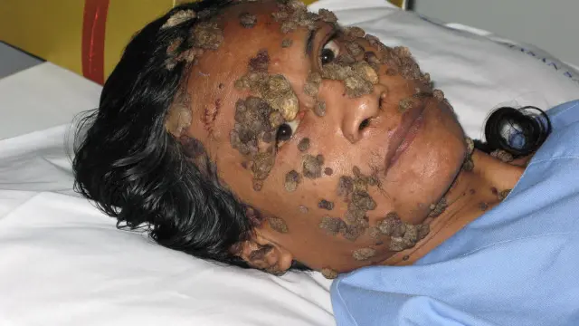 6 Manusia Bersisik Menggemparkan