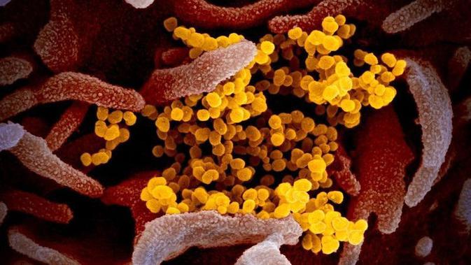 Gambar mikroskop elektron pemindaian ini menunjukkan SARS-CoV-2 (kuning) di antara sel manusia (merah muda). Virus ini diisolasi dari seorang pasien di AS (Warna telah ditambahkan ke gambar untuk lebih menunjukkan virus dan lingkungann (Source: NIAID-RML)