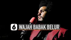 Wajah musisi The Weeknd tampak lebam hingga berdarah seperti bekas dipukuli saat acara MTV Video Music Awards 2020.