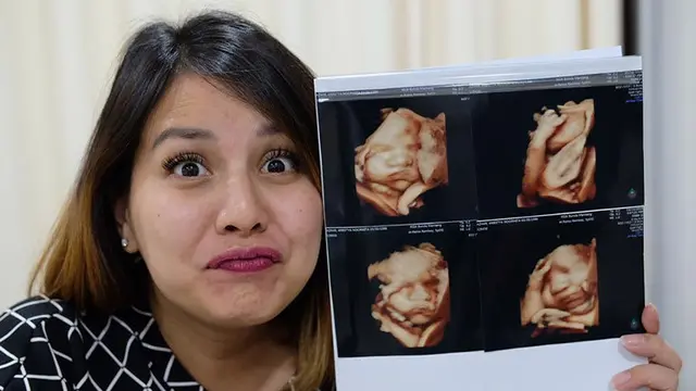 6 Pose Unik Anak Seleb saat di USG, Anak Cut Meyriska Bergaya Metal