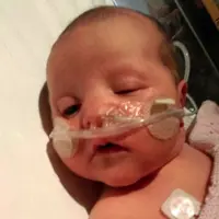 Frankie Morrison, bayi yang terlahir dengan air yang memenuhi tubuh. (SWNS)