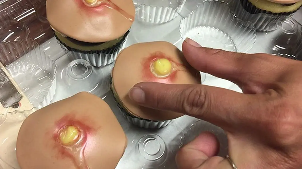 [Bintang] Cupcakes Jerawat, Makanan Paling Menjijikan Abad Ini!