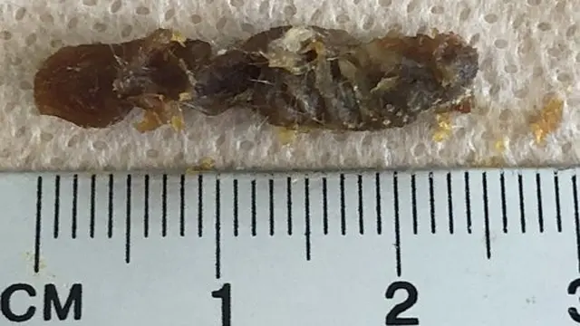 kotoran telinga terbesar di dunia