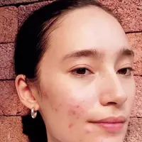 Orang mengira selama ini Tatjana Saphira cantik flawless tanpa kekurangan. [Instagram.com/tatjanasaphira]