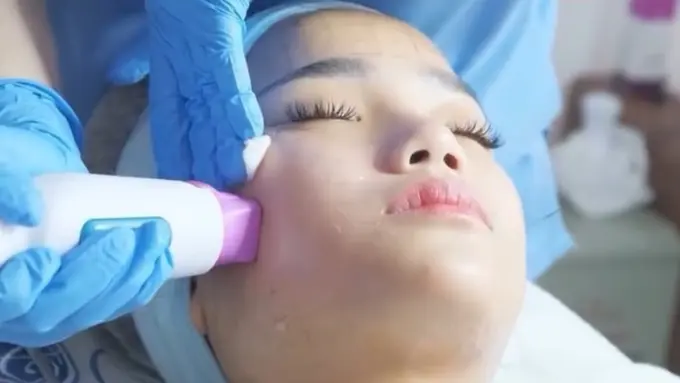 Thermage FLX, Teknologi Canggih untuk Kulit Awet Muda Tanpa Operasi