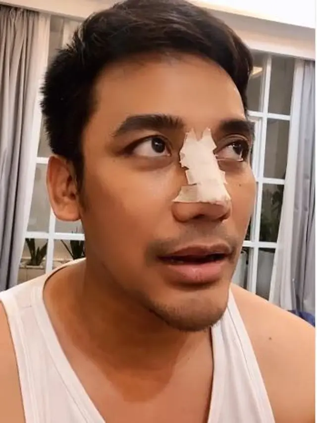 Ungkap Alasan Operasi Plastik, Ini 6 Potret Terbaru Bubah Alfian yang Bikin Pangling