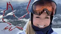 Lindsey Vonn Injured at 2026 Winter Olympics, Breaks Left Leg