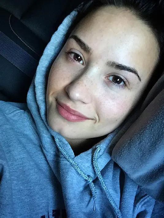 Kini kondisi kesehatan Demi Lovato sendiri sudah membaik dan dikabarkan tengah melakukan rehabilitasi. (instagram/ddlovato)