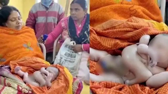 Viral Bayi Lahir dengan 4 Tangan dan 4 Kaki, Disebut Titisan Dewa