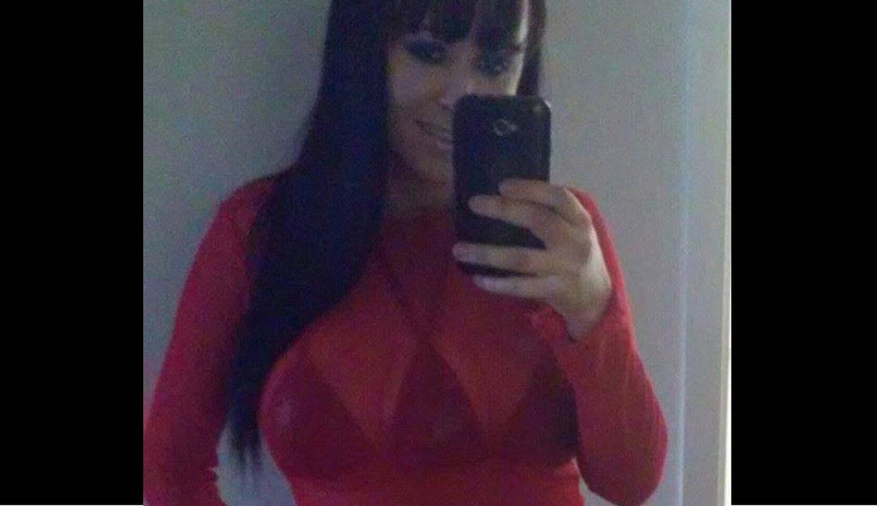 Terobsesi Jadi Artis Wanita Ini Miliki 3 Payudara Foto Liputan6 Com