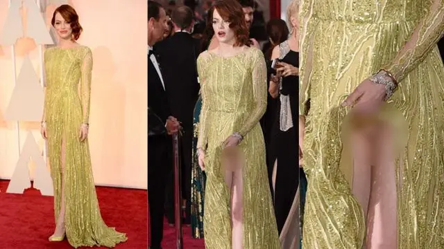 Emma Stone