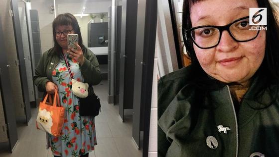 VIDEO: Perempuan Ini Pingsan Tiap Dengar Suara Keras