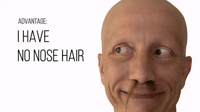 Idap Alopecia Universalis, Pria Ini Tunjukkan Kisahnya Melalui Potret Unik