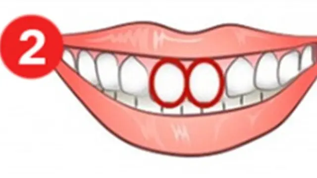 Kepribadian Berdasarkan Bentuk Gigi Oval