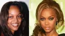 Model kelas dunia, Tyra Banks pun mengaku dirinya melakukan operasi hidung sebelum memulai kariernya. (Celebrity plastic surgery online)