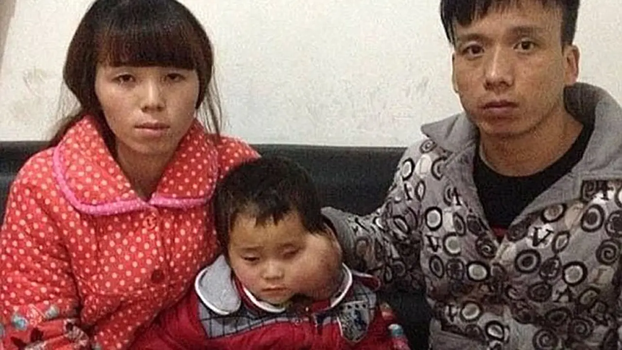 Anak Kena Kanker Mata, Orangtua Ini Minta Bantuan
