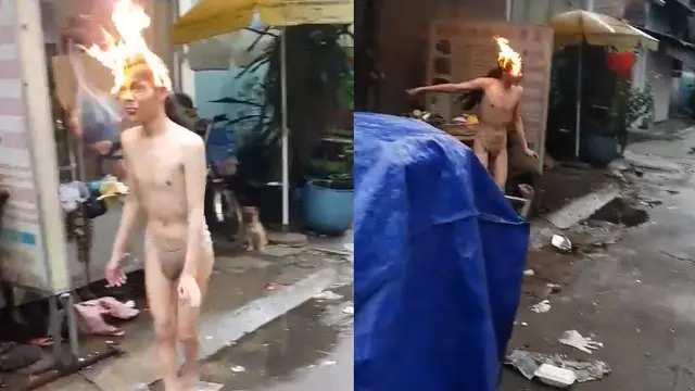 Pengaruh Narkoba, Pria Ini Tak Sadar Kepalanya Terbakar