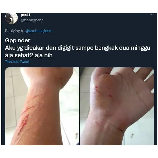 7 Potret Ulah Kucing Bandel Cakar Majikan Ini Bikin Ngilu