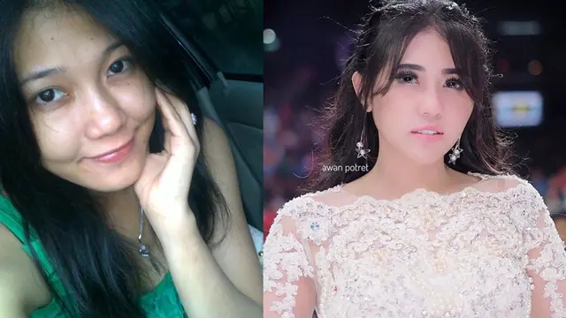 Penampilan Berbeda Drastis, 5 Seleb ini Dituding Operasi Plastik