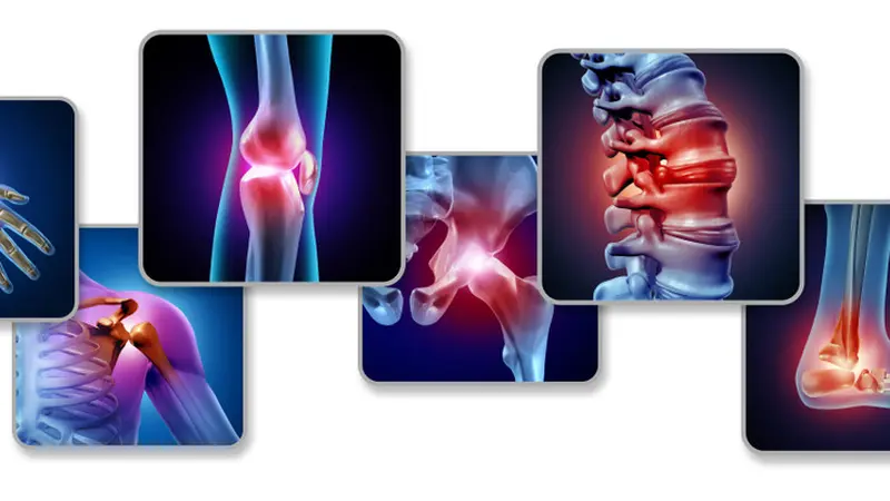 Kenali Lebih Dini Osteoporosis dan Osteoarthritis