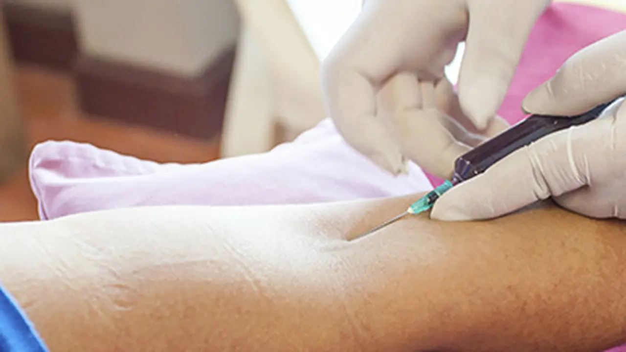 Ini Alasannya Kenapa Tes A1C Penting untuk Diabetesi