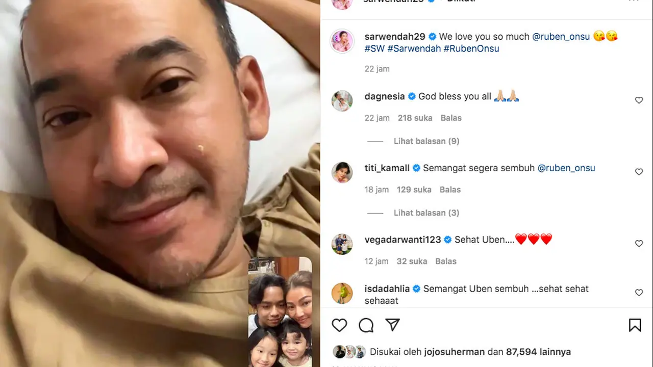 Ruben Onsu Mulai Jalani Pengobatan di Singapura